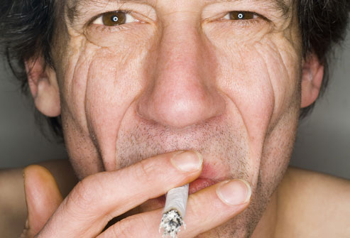 活到70岁的吸烟者仍然失去了约4年的寿命